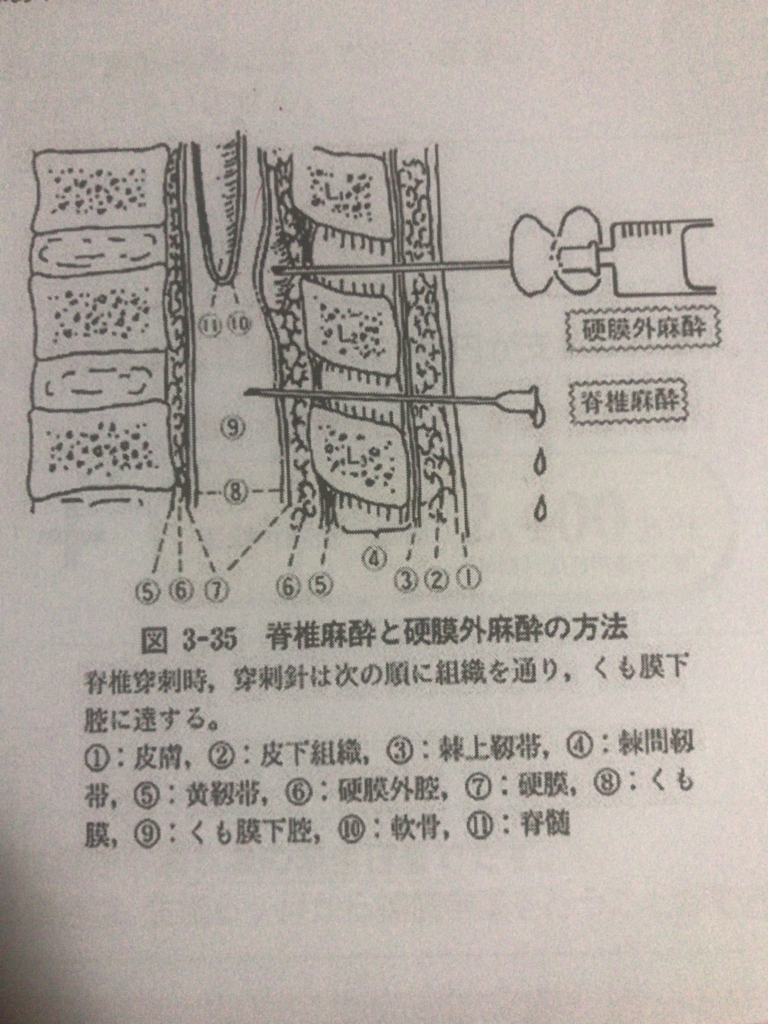 f:id:chinamk:20180214213927j:plain